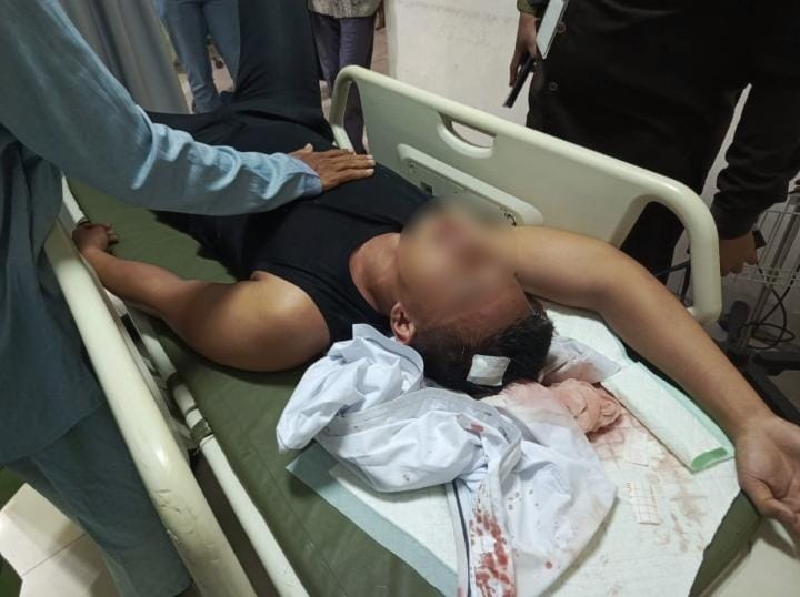 Diduga Dikeroyok Kakak Kelas, Pelajar SMA di Lubuklinggau Alami Bocor di Kepala  