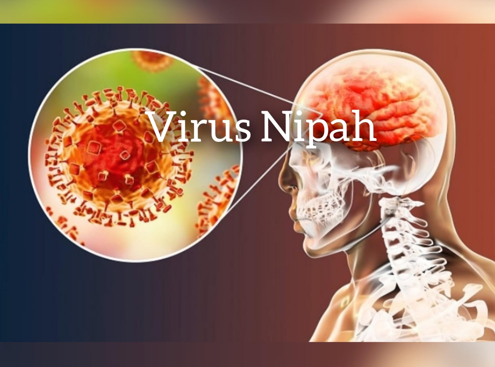 DANGER! Virus Nipah Lebih Parah dari Covid-19, Cermati Gejala dan Begini Cara Mencegahnya!