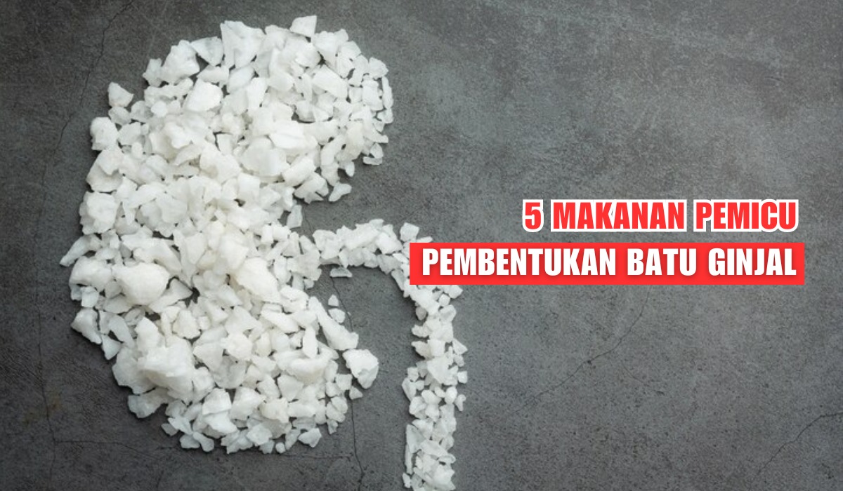 Harus Dibatasi! 5 Jenis Makanan Ini Memicu Pembentukan Batu Ginjal, Ini Dia Daftarnya?