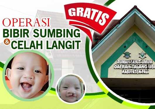 RSUD PALI Berikan Operasi Bibir Sumbing Gratis Bagi Anak