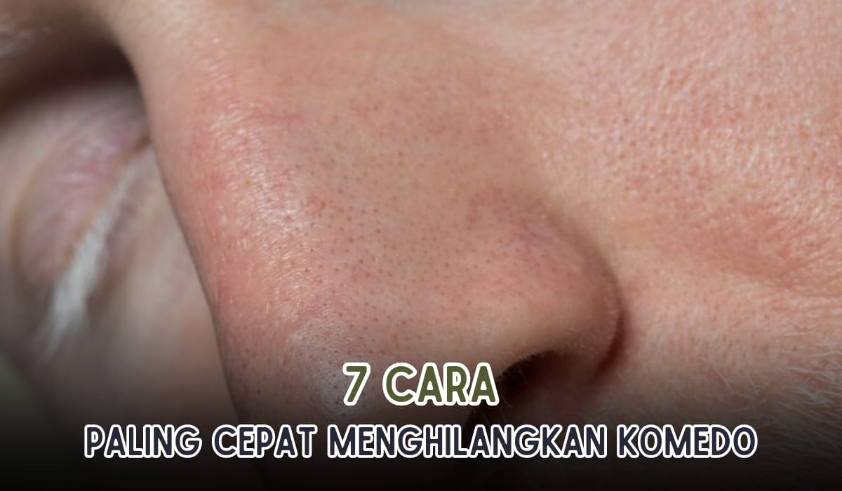 7 Cara Menghilangkan Komedo dengan Cepat dari Bahan Alami, Bebas Flek Hitam Bahannya Mudah Dicari 