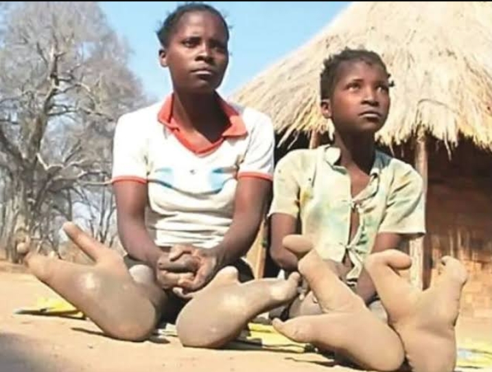 Kisah Unik Suku di Pedalaman Zimbabwe, Mulai dari Kaki Mirip Burung Unta Hingga Perkawinan Sedarah