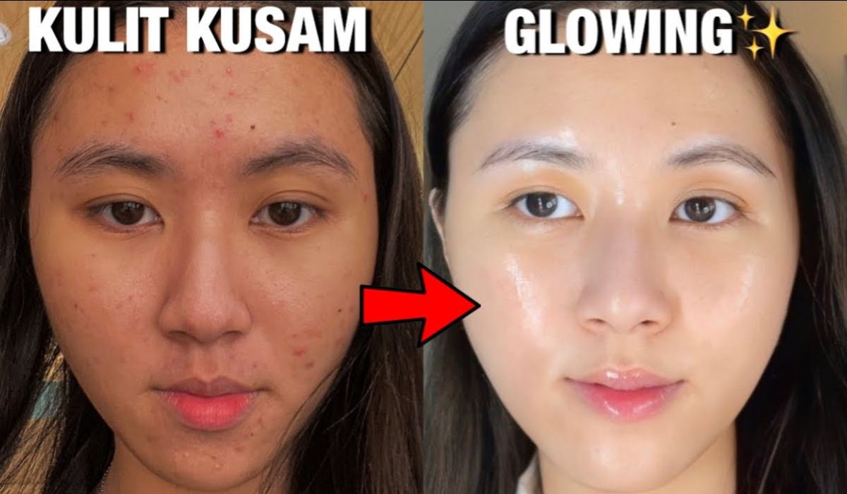 Rahasia Kulit Glowing Permanen Tanpa Biaya Mahal, Cuma Gunakan Ini, Langsung Putih dalam Sekejap, Mau?