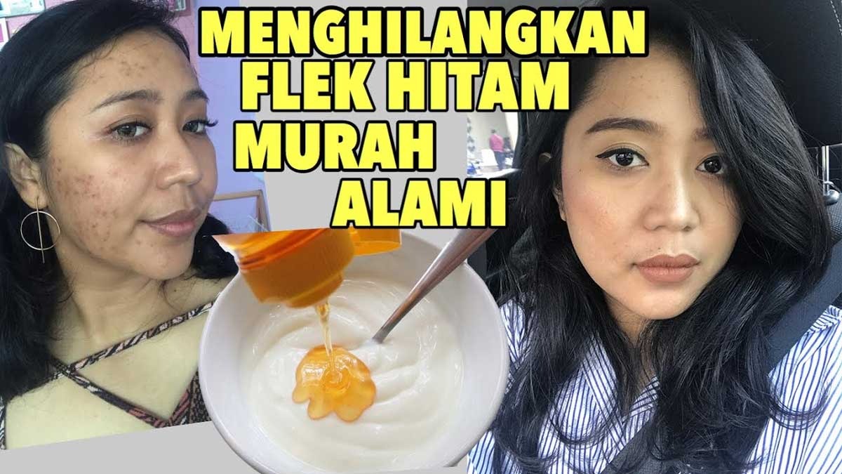 7 Cara Menghilangkan Flek Hitam di Wajah Secara Alami yang Cocok untuk Remaja, Tak Perlu ke Klinik Kecantikan 