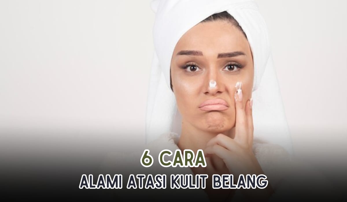 6 Cara Menghilangkan Kulit Belang di Wajah, 100 Persen Bahan Alami serta Aman dan Mudah 