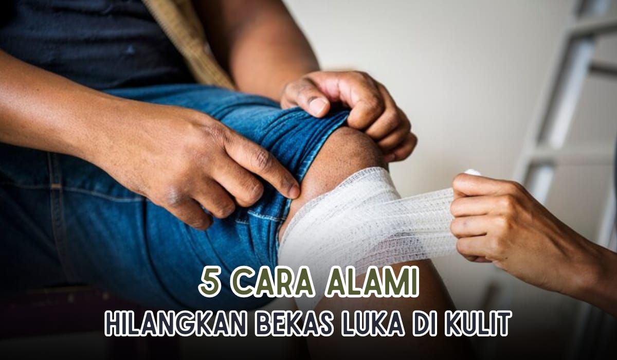 5 Cara Alami untuk Menghilangkan Bekas Luka di Kulit, Noda Bekas Luka Langsung Pudar