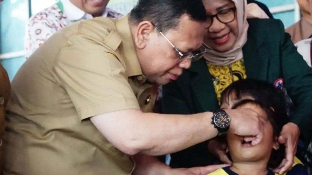 236 Anak di Palembang Ditargetkan Dapat Imunisasi Polio, Pj Walikota Palembang: Pertahankan Zero Polio 