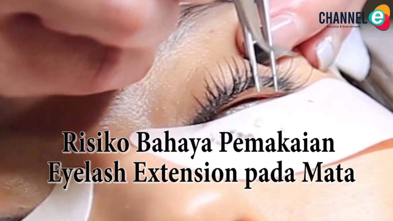 Hati-Hati Pakai Eyelash Extension, Walau Bikin Cantik, Tapi Berbahaya Buat Kesehatan Mata   