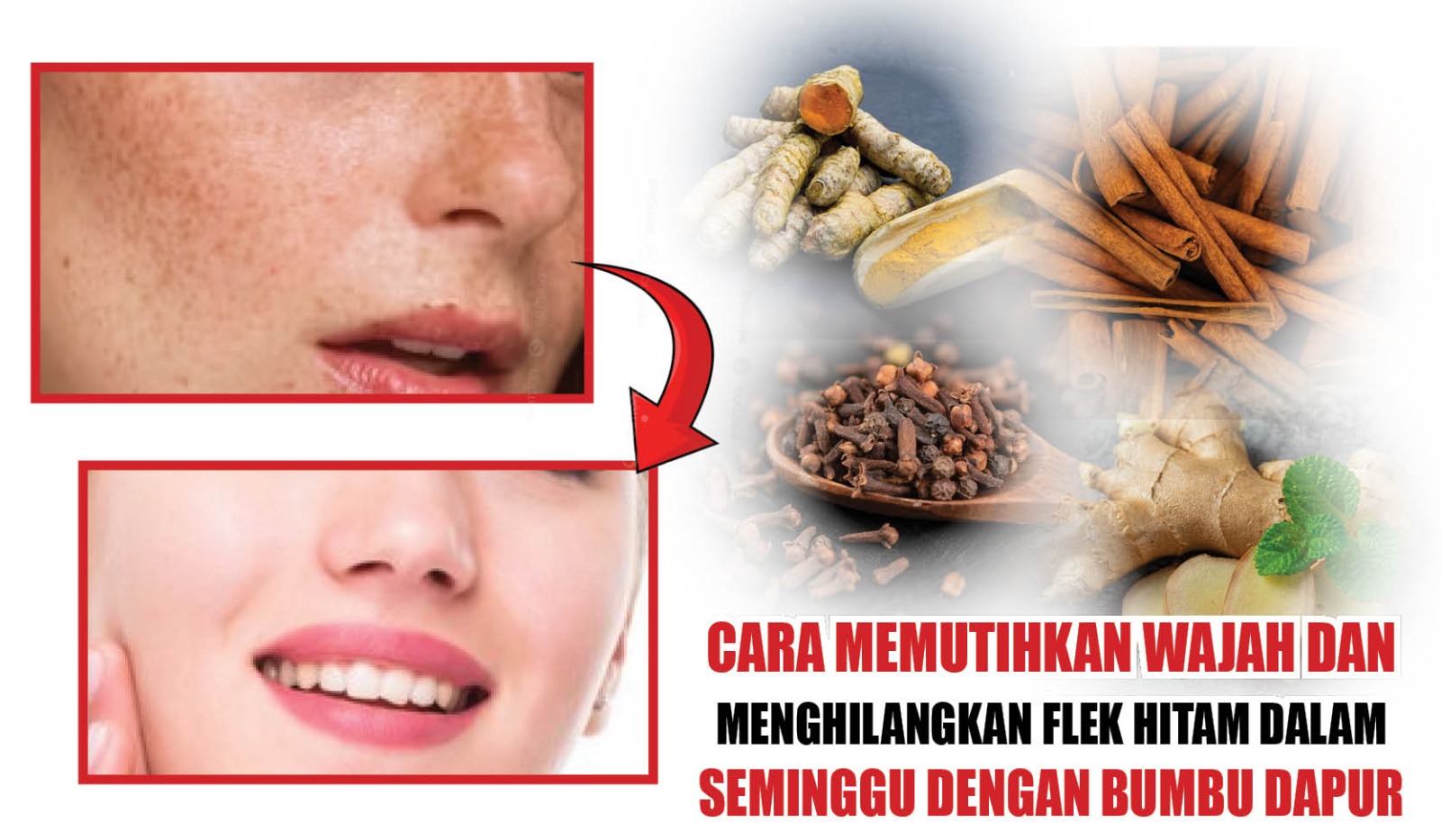 Cara Memutihkan Wajah dan Menghilangkan Flek Hitam dalam Seminggu dengan Bumbu Dapur 