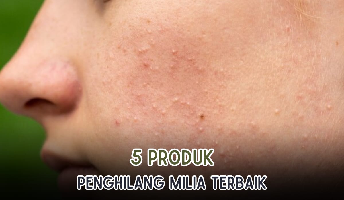 Rekomendasi 5 Produk Menghilangkan Milia Terbaik, Wajah Kembali Mulus dan Tidak Bikin Iritasi