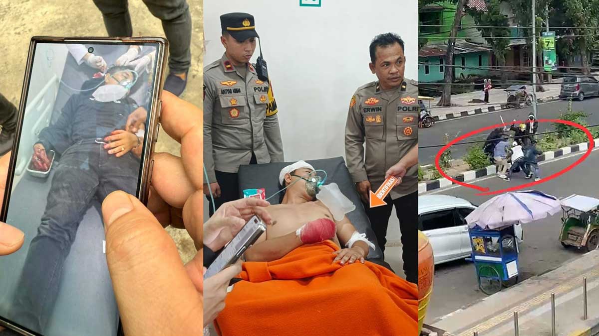 Kondisi Terkini Korban Saling Serang PS Mall Palembang, Jari Putus dan Luka Serius, Ini Sosoknya