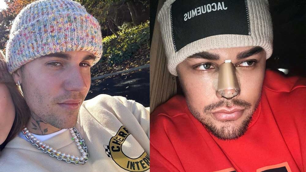 Pamer Foto Hidung Diperban Habis Oplas di Turki, Ivan Gunawan Dibilang Mirip Justin Bieber