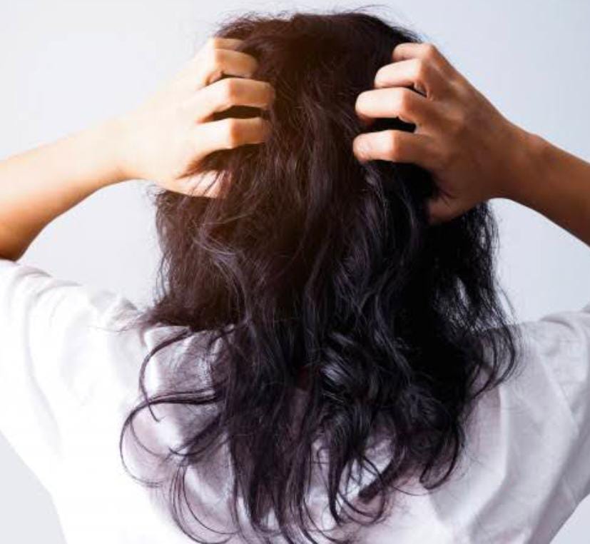 Hindari Kebiasaan ini, Jika Tak Ingin Rambutmu Rusak