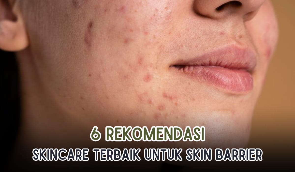 6 Rekomendasi Skincare Terbaik Untuk Skin Barrier, Pulihkan Kulit yang Rusak Akibat Krim Abal-Abal!