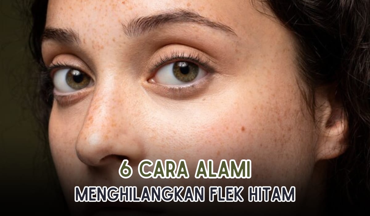 Bye Bintik Hitam! Ini 6 Cara Mudah Menghilangkan Flek Hitam Menggunakan Bahan Alami, Ampuh Banget!