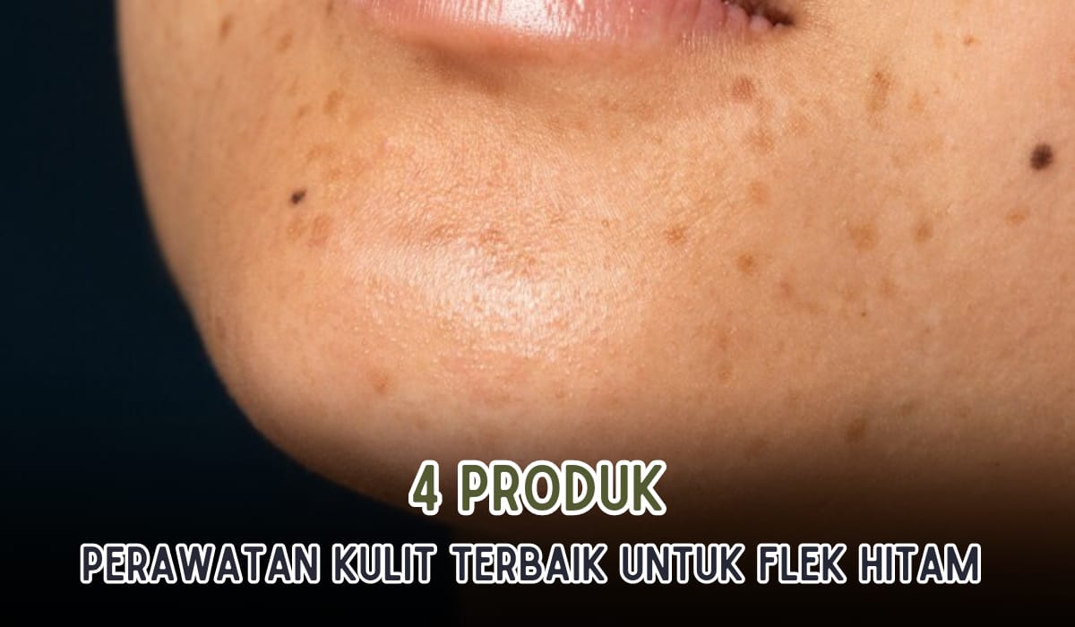 4 Produk Perawatan Kulit Terbaik Atasi Flek Hitam, Dijamin Noda Hitam Tersamarkan dalam 7 Hari!   