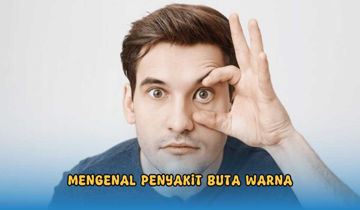 Jangan Anggap Sepele Buta Warna, Kenali Jenis dan Gejalanya! 