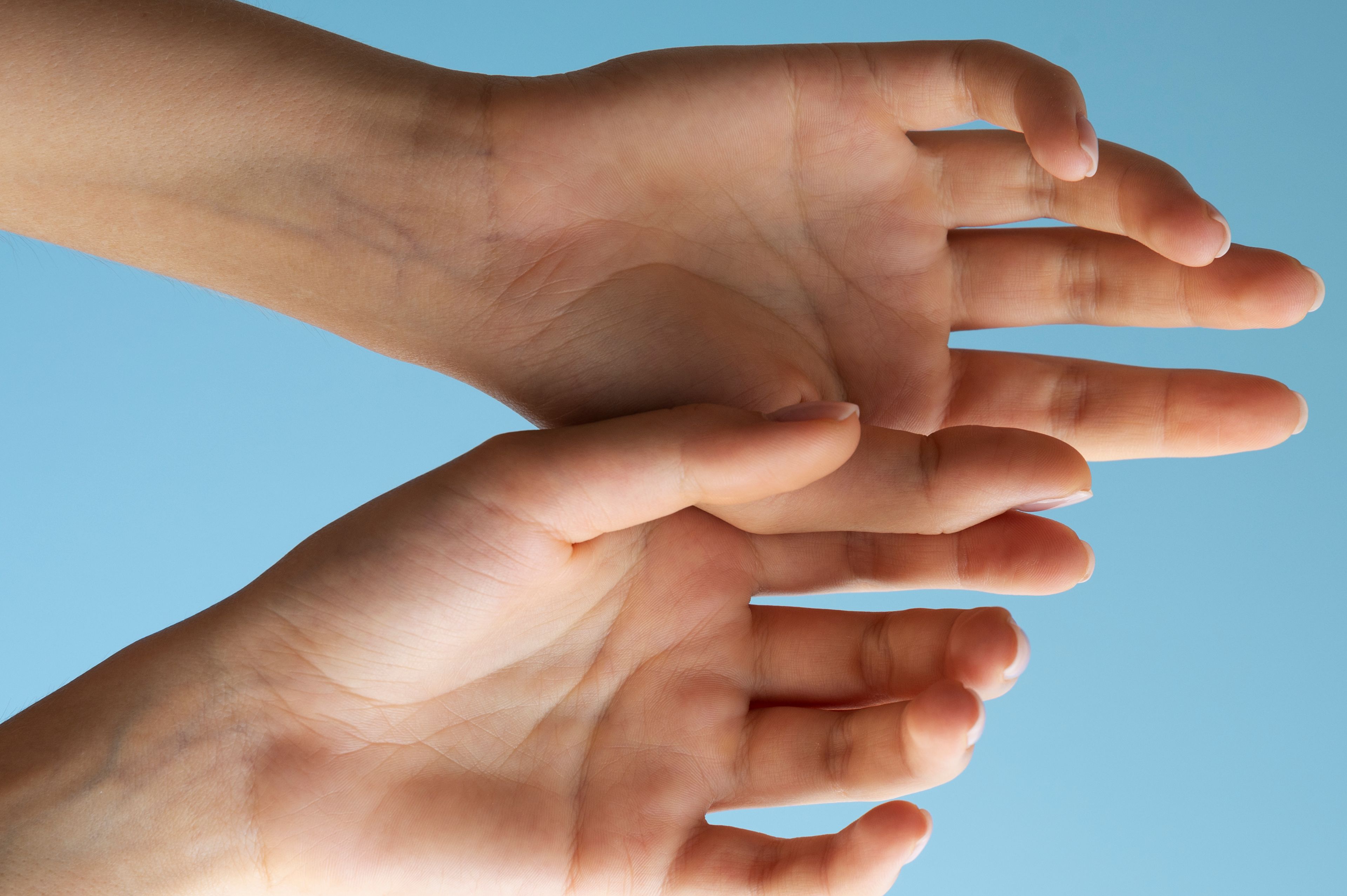 Telapak Tangan Kuning, Benarkah Penyakit Berbahaya? Simak Penjelasannya