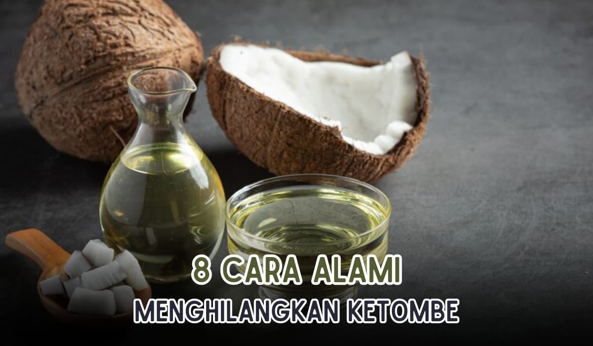 Bahan Alami Lebih Ajib, Ini 8 Cara Menghilangkan Ketombe Membandel, Hitungan Hari Langsung Hilang!