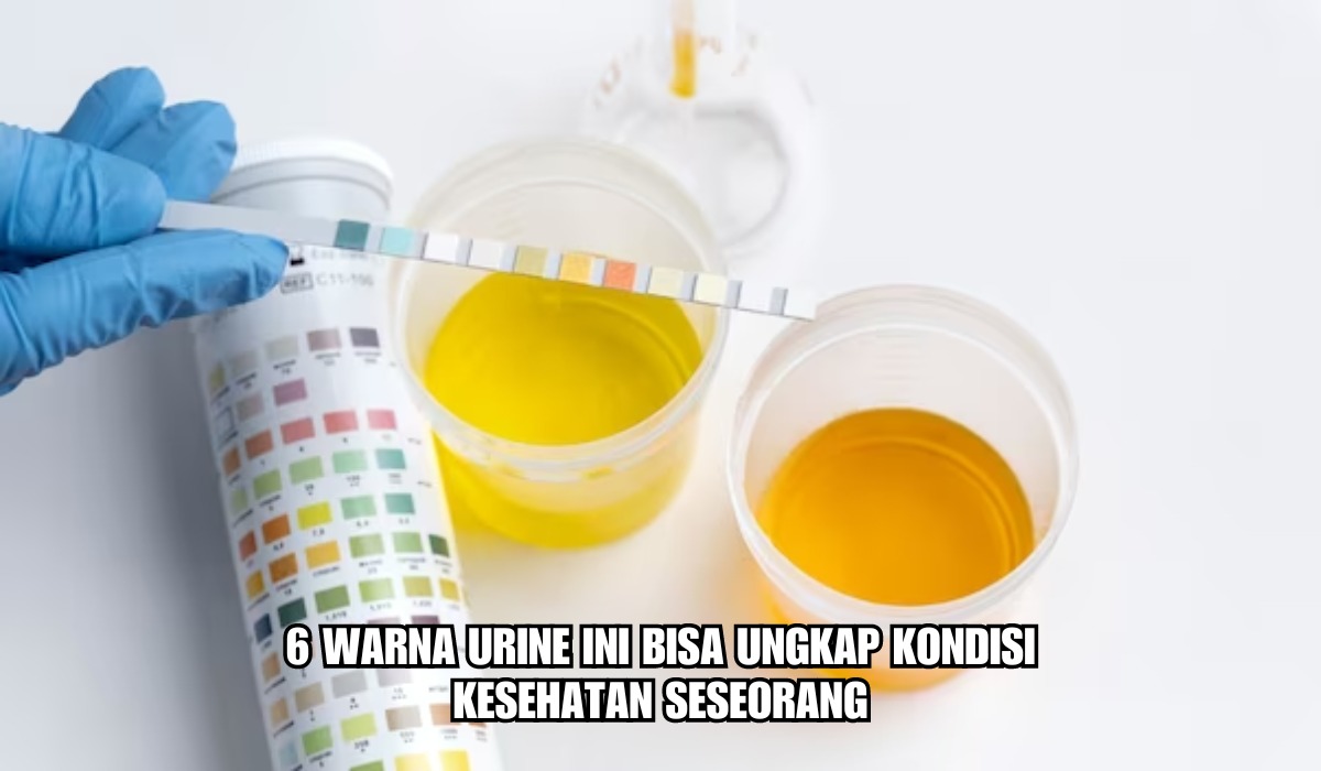 6 Warna Urine Ini Bisa Ungkap Kondisi Kesehatan Seseorang, Pertanda Penyakit Apa?