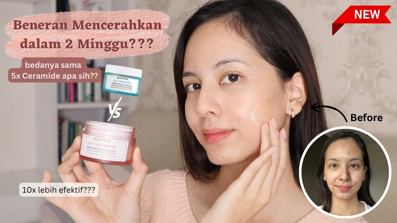 7 Merk Skincare dengan Kandungan Niacinamide Terbaik, Buat Wajah Jadi Glowing dan Bebas Belang