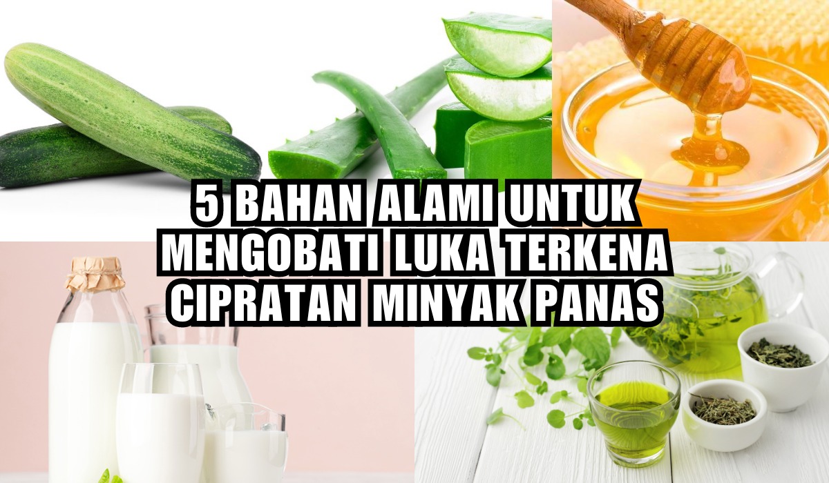 Terkena Cipratan Minyak Panas? Jangan Panik! Ini 5 Bahan Alami Untuk Obati Luka