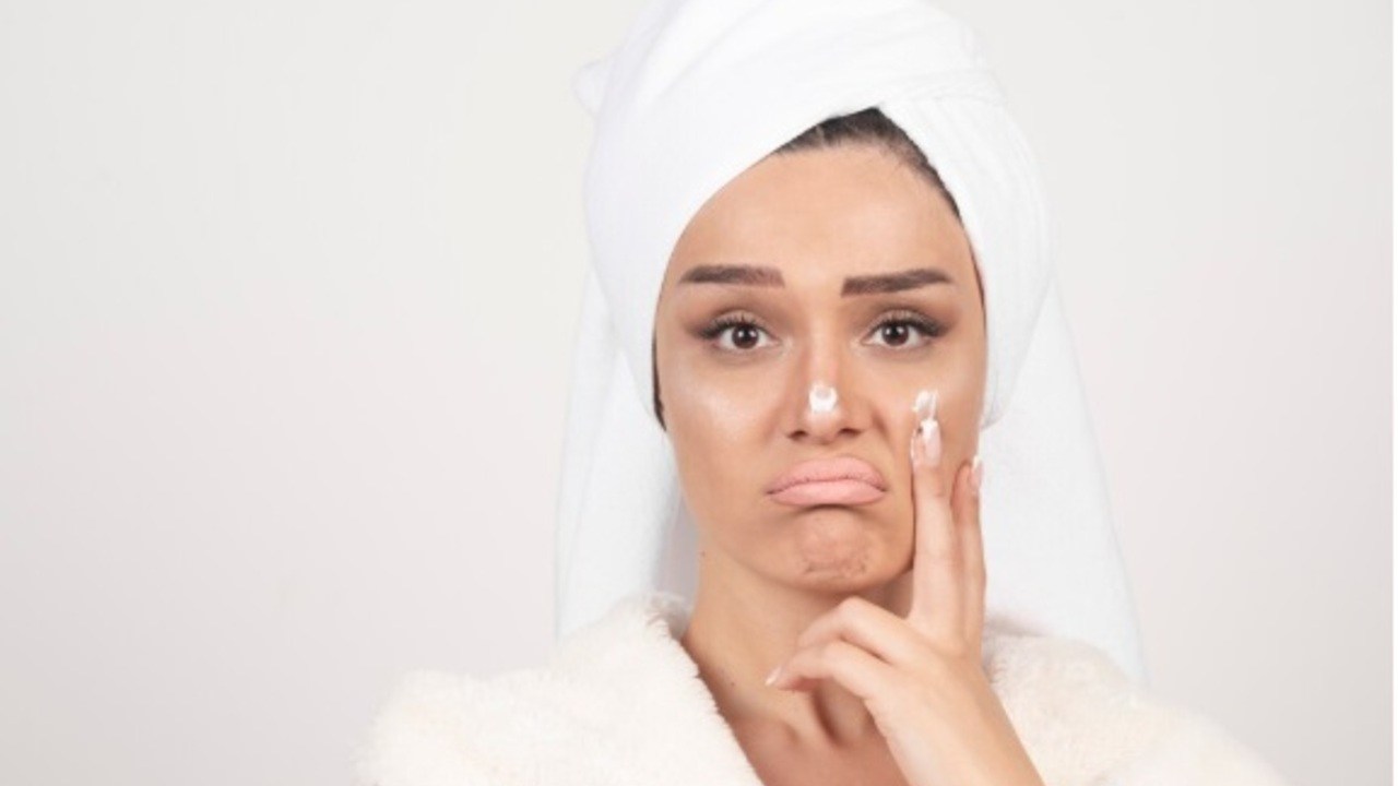 Tak Perlu Skincare Mahal! Ini 4 Cara Alami Usir Bintik Hitam di Wajah