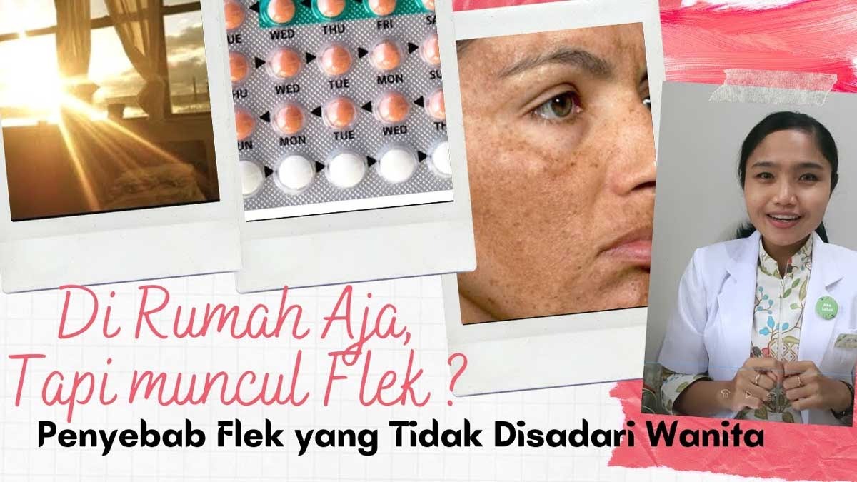 Wajah Penuh dengan Flek, Tapi Jarang Keluar Rumah, Kok Bisa? Ini Penyebabnya