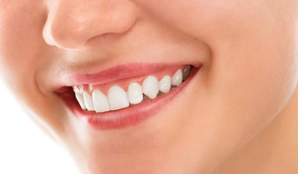 6 Tips Memutihkan Gigi secara Alami dengan Mudah dan Cepat, Nomor 1 Sering Diabaikan!