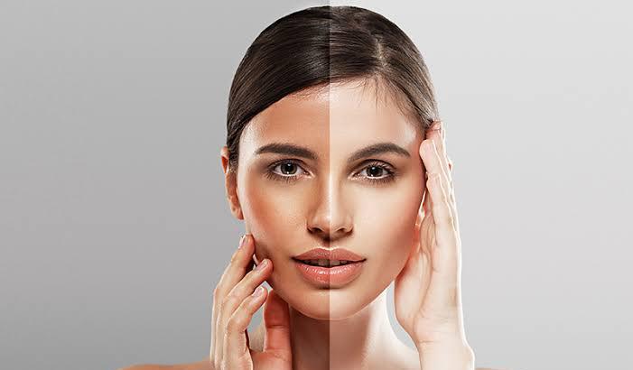 Sayonara Kulit Belang, Ini 6 Brand Skincare yang Paling Ampuh Meratakan Warna Kulit