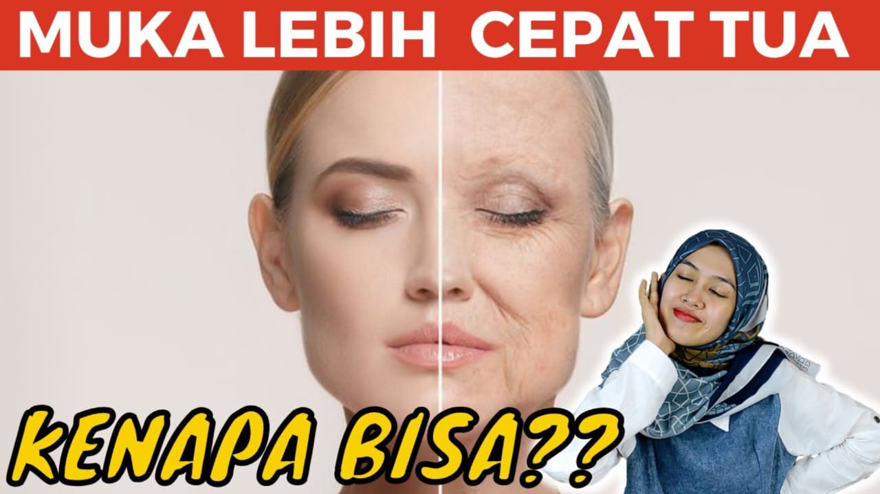 6 Penyebab Penuaan Dini pada Kulit Wajah, Nomor 5 Kebiasaan yang Sering Dialami Anak Muda 