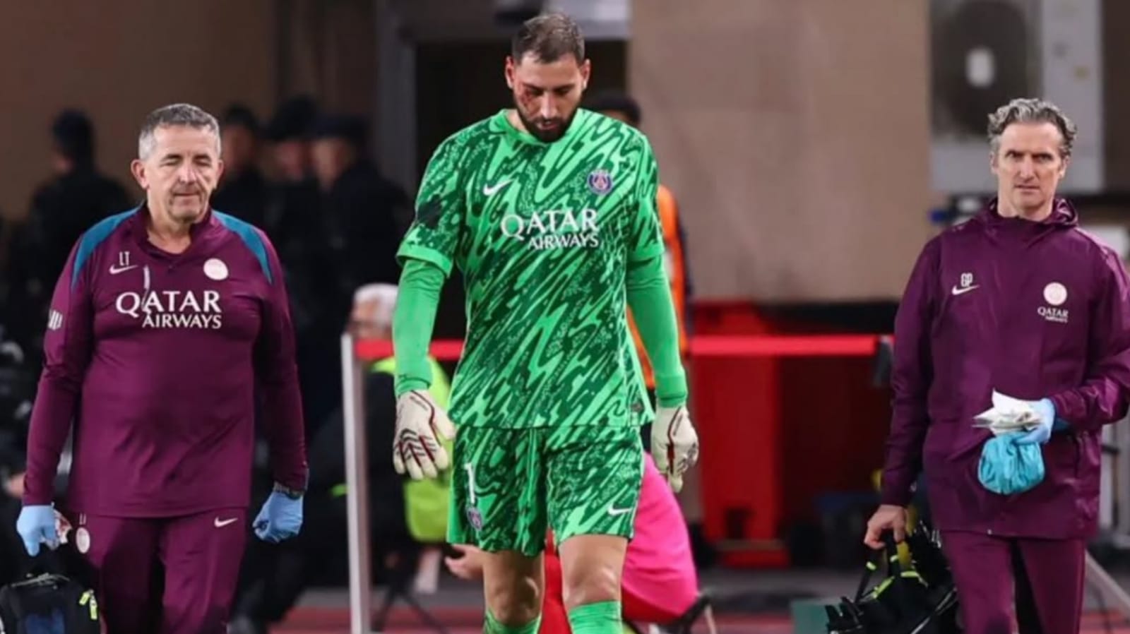 Fakta dan Kabar Terbaru Gianluigi Donnarumma Setelah Mengalami Cedera Wajah