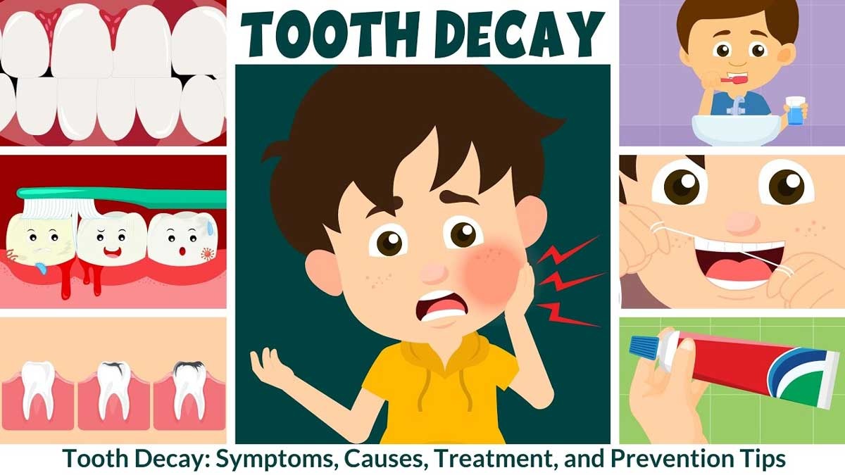 Anak Sering Mengeluh Nyeri di Mulut, Harap Waspada, Kenali Tanda-Tanda Penyebab Sakit Gigi