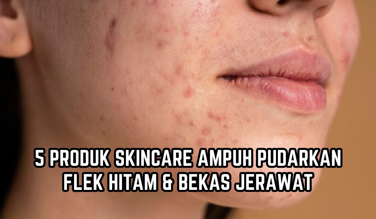5 Skincare yang Ampuh Pudarkan Flek Hitam dan Bekas Jerawat, Bikin Wajah Kusam Jadi Cerah