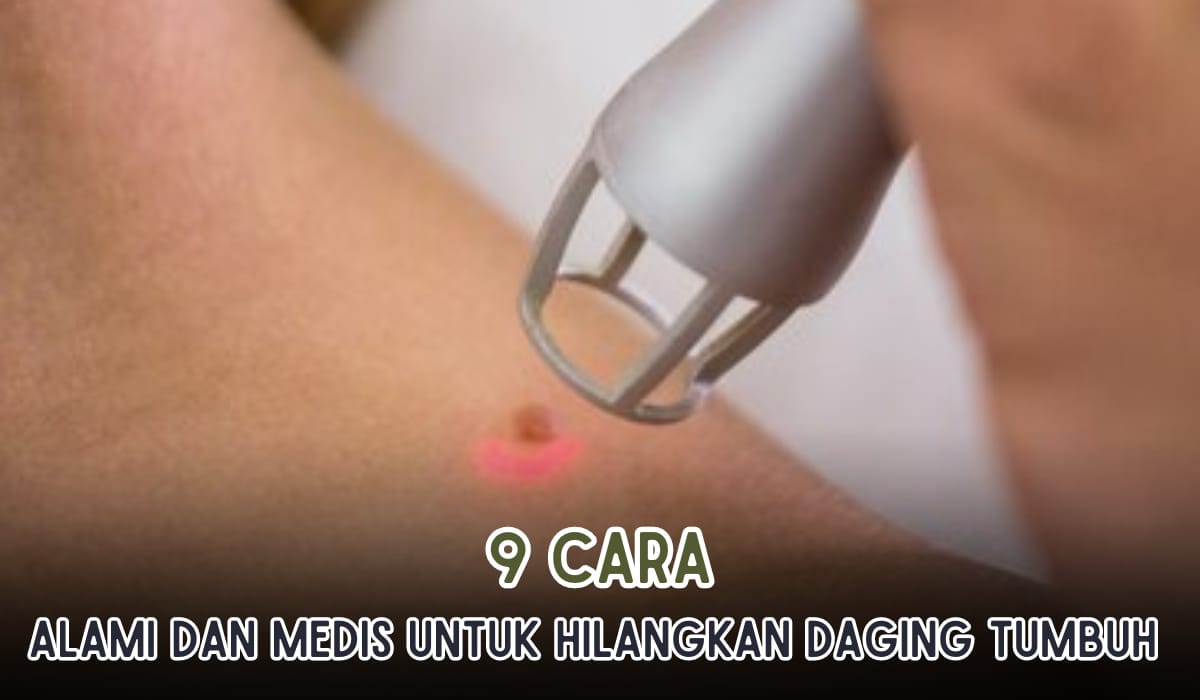 9 Cara Menghilangkan Daging Tumbuh secara Alami dan Medis, Cuma Modal Cotton Bud Dijamin Manjur 