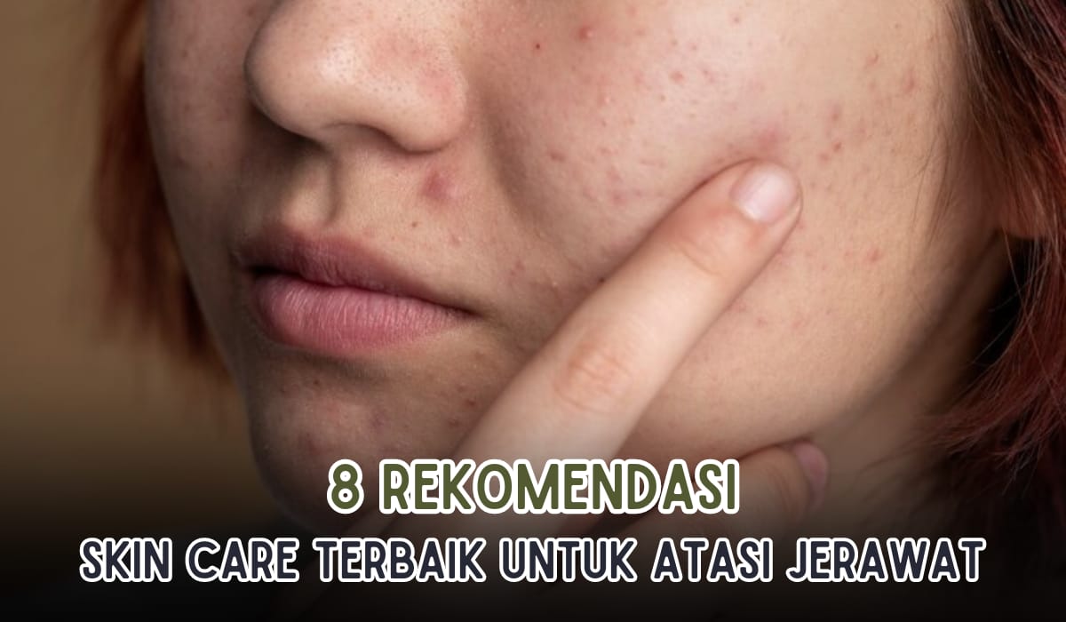 Bye Jerawat! Rekomendasi 8 Skincare yang Ampuh Menghilangkan Jerawat di Wajah, Wajib Ada di Tas Wanita