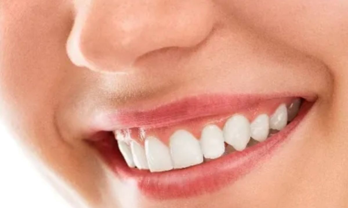 7 Cara Mendapatkan Gigi Putih Bersih Menggunakan Bahan Alami, gak Perlu Mahal