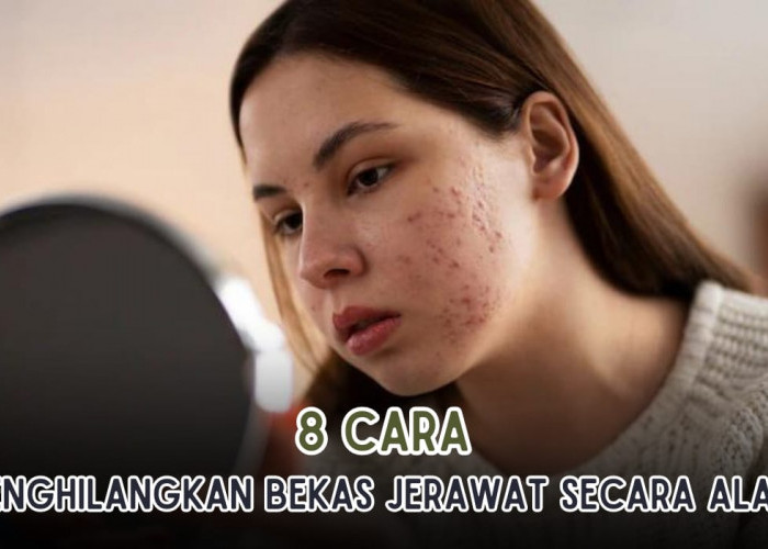 8 Cara Menghilangkan Bekas Jerawat Pakai Bahan Alami, Cuma 3 Kali Noda Hitam Langsung Ambyar