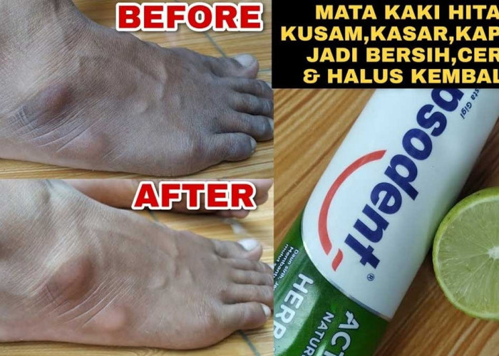 Lakukan Cara Ini! Agar Punggung Kaki Cerah dan Tidak Kusam dan Belang