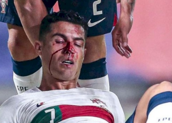 Portugal Kuasai Puncak Usai Pesta Gol, Cristiano Ronaldo Berdarah