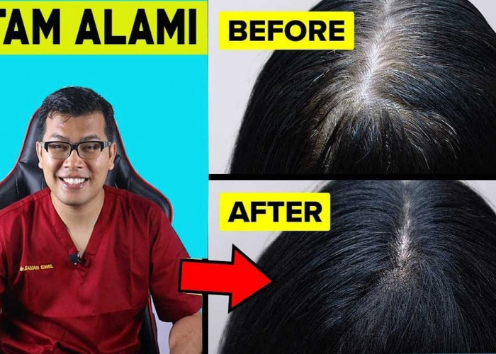 15 Cara Ampuh Merawat Rambut Tanpa Menggunakan Sampo, Bahan Alami Ini Bisa Bersihkan Kulit Kepala 
