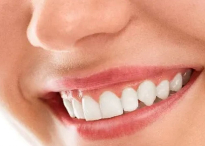 Ini 7 Cara Membersihkan Gigi dengan Bahan Alami, yuk simak ulasannya