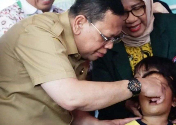 236 Anak di Palembang Ditargetkan Dapat Imunisasi Polio, Pj Walikota Palembang: Pertahankan Zero Polio 