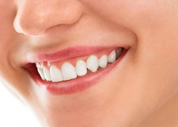 7 Cara Memutihkan Gigi dengan Mudah, Bisa Putih Permanen Cuma Pakai Bahan Alami