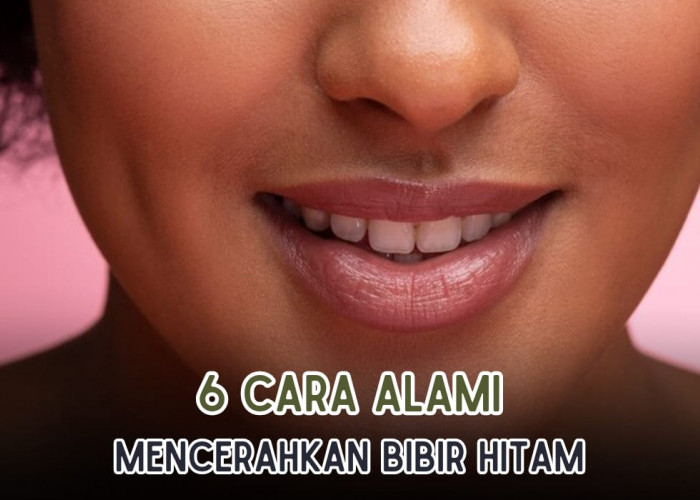 6 Cara Mudah Mengatasi Bibir Hitam, Cukup Lakukan Hal Mudah Ini Bibir Cerah Kembali
