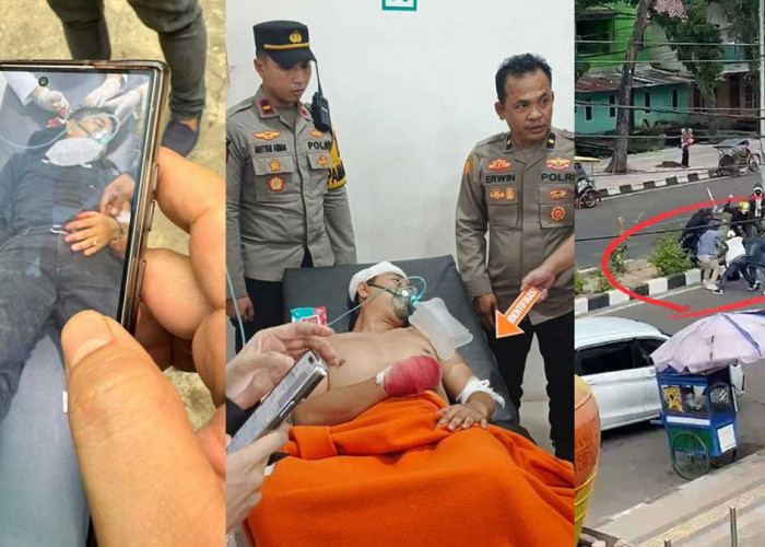 Kondisi Terkini Korban Saling Serang PS Mall Palembang, Jari Putus dan Luka Serius, Ini Sosoknya