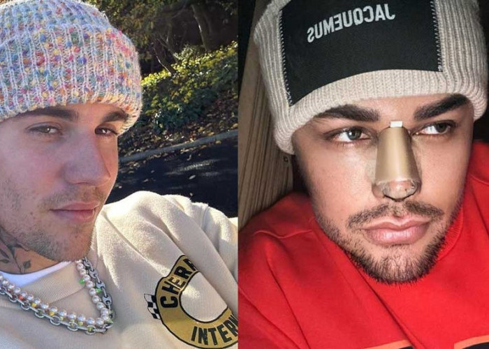 Pamer Foto Hidung Diperban Habis Oplas di Turki, Ivan Gunawan Dibilang Mirip Justin Bieber