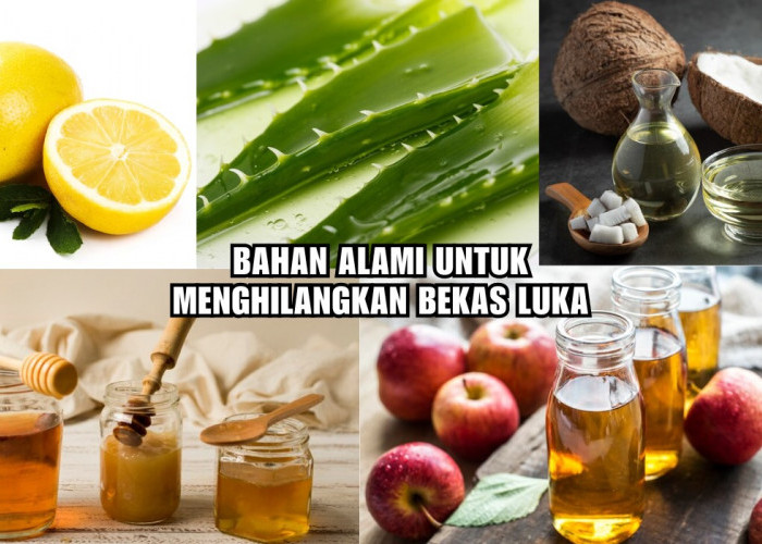 Cuma Gunakan 5 Bahan Alami Ini Bekas Luka Cepat Hilang, Manjur dan Efektif!