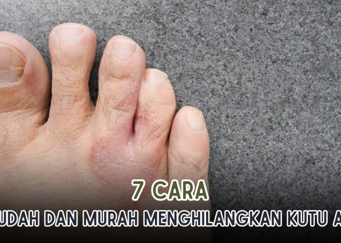 7 Cara Mudah dan Ampuh Menghilangkan Kutu Air Secara Alami, Bahannya Sederhana!