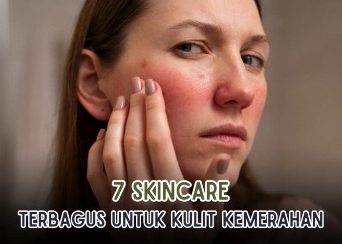 Kulit Sensitif Merapat! Ini 7 Produk Skincare Terbaik untuk Kulit yang Iritasi dan Kemerahan